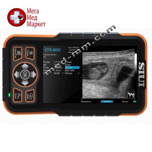 Ветеринарный УЗИ аппарат SIUI Apogee CTS-800